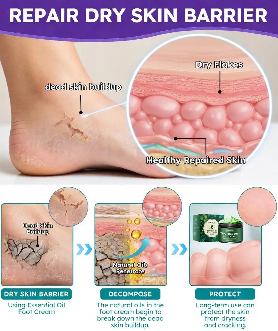 NEWYUOTM Tea Tree Oil Foot Cream