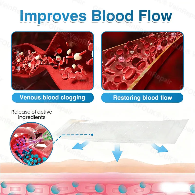 🇦🇺👨‍⚕️✅⭐GFOUK® VeinRepair Microneedle Patch Roll⚡Instant Relief, Long-Term Results